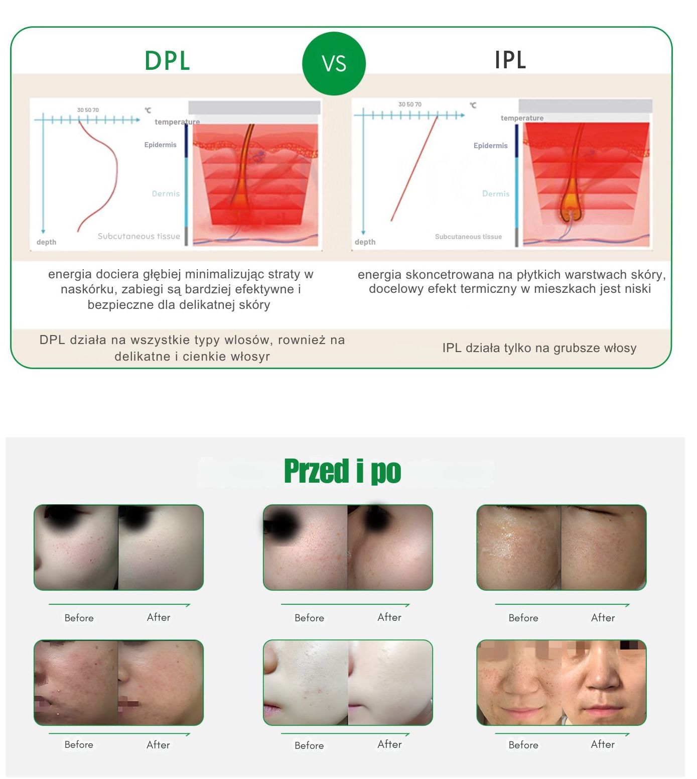 Porównanie DPL i IPL